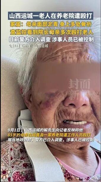 91微操盘 85岁老人在养老院被揍到骨折！凌晨挨打2小时，院长还帮着隐瞒！